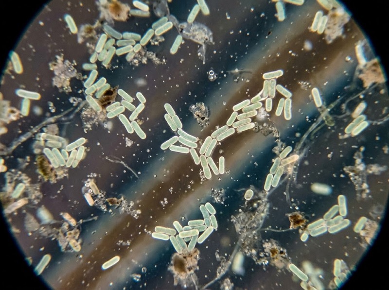 Nước nhiễm E. coli: Nguyên nhân, tác hại và cách xử lý